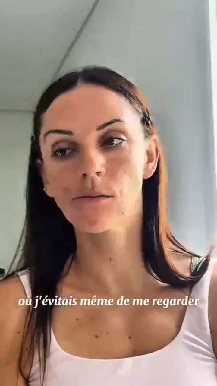 Acne supplement · Video ad, FR